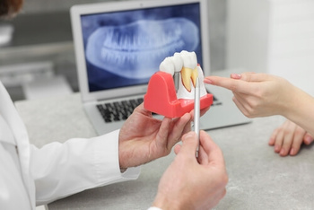 Cost Of Dental Implants In Australia
