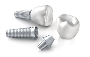 Dental Implant Thailand parts